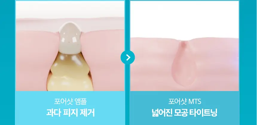 [모공수축] 셀올로지 포어샷 MTS (MTS/앰플/카트리지) 상세페이지 13